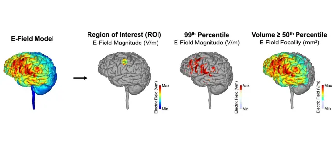 Researchers Develop New Technique for Noninvasive Brain Stimulation